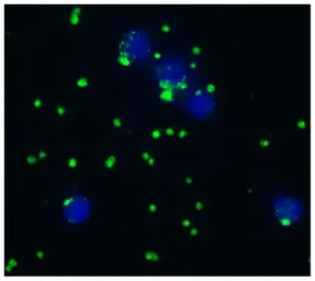 Anti-Integrin alpha 2b + beta 3 antibody [IVA30] used in Immunocytochemistry/ Immunofluorescence (ICC/IF). GTX23919