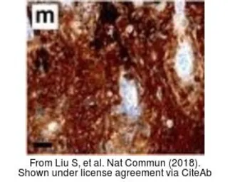 Anti-S100 antibody [4C4.9] used in Immunohistochemistry (IHC). GTX24066