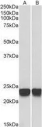 Anti-Park7 / DJ-1 antibody used in Western Blot (WB). GTX24150