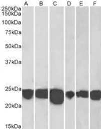 Anti-Park7 / DJ-1 antibody used in Western Blot (WB). GTX24150