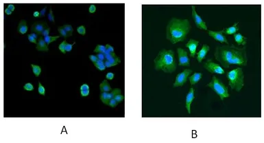 Anti-Park7 / DJ-1 antibody used in Immunocytochemistry/ Immunofluorescence (ICC/IF). GTX24150