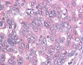 Anti-Survivin antibody [60.11] used in IHC (Paraffin sections) (IHC-P). GTX24470