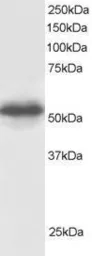 Anti-CSN1 antibody, C-term used in Western Blot (WB). GTX24535