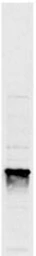 Anti-Fibrillarin antibody [38F3] used in Western Blot (WB). GTX24566