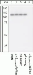 Anti-Rb (phospho Ser249) antibody used in Western Blot (WB). GTX24788