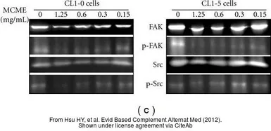 Anti-FAK (phospho Tyr397) antibody used in Western Blot (WB). GTX24803