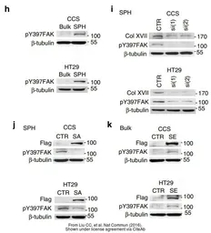 Anti-FAK (phospho Tyr397) antibody used in Western Blot (WB). GTX24803