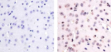 Anti-PYK2 (phospho Tyr579) antibody used in IHC (Paraffin sections) (IHC-P). GTX24805