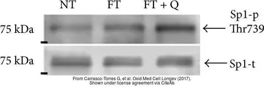 Anti-Src (phospho Tyr416) antibody used in Western Blot (WB). GTX24816