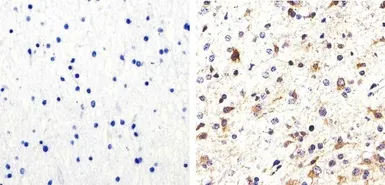 Anti-Tau (phospho Ser214) antibody used in IHC (Paraffin sections) (IHC-P). GTX24846