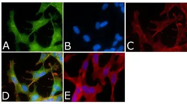 Anti-Tau (phospho Ser214) antibody used in Immunocytochemistry/ Immunofluorescence (ICC/IF). GTX24846