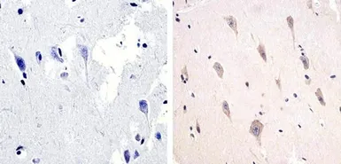 Anti-Tau (phospho Thr217) antibody used in IHC (Paraffin sections) (IHC-P). GTX24851
