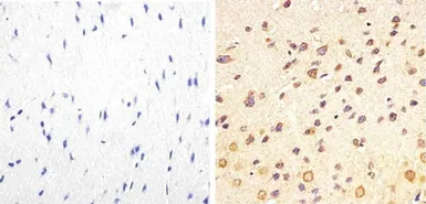 Anti-Tau (phospho Thr217) antibody used in IHC (Paraffin sections) (IHC-P). GTX24851