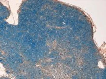 Anti-STAT3 (isoform 1/2) antibody, C-term used in IHC (Paraffin sections) (IHC-P). GTX25073