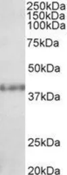 Anti-SUV39H2 antibody, C-term used in Western Blot (WB). GTX25264