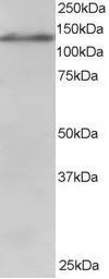 Anti-USP11 antibody, C-term used in Western Blot (WB). GTX25269