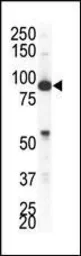 Anti-EphA4 antibody used in Western Blot (WB). GTX25396