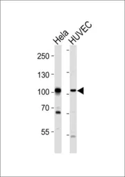 Anti-EphA4 antibody used in Western Blot (WB). GTX25396