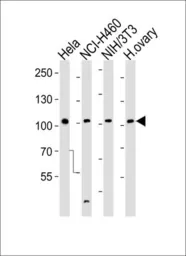 Anti-EphA4 antibody used in Western Blot (WB). GTX25396