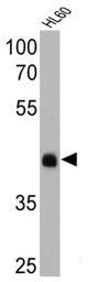 Anti-Rhodopsin antibody [1D4] used in Western Blot (WB). GTX25417