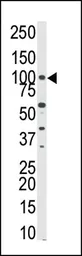 Anti-PKN beta antibody used in Western Blot (WB). GTX25440