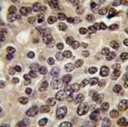 Anti-PKN beta antibody used in IHC (Paraffin sections) (IHC-P). GTX25440