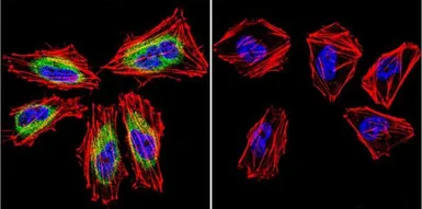 Anti-Calpain 1 antibody [2H2A7C2] used in Immunocytochemistry/ Immunofluorescence (ICC/IF). GTX25441