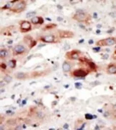 Anti-VPS34 antibody used in IHC (Paraffin sections) (IHC-P). GTX25451