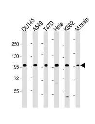 Anti-FGFR2 antibody used in Western Blot (WB). GTX25476