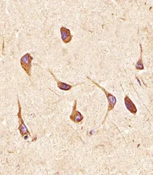 Anti-FGFR2 antibody used in IHC (Paraffin sections) (IHC-P). GTX25476