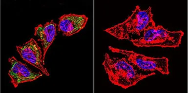 Anti-HSP60 antibody [2E1/53] used in Immunocytochemistry/ Immunofluorescence (ICC/IF). GTX25479