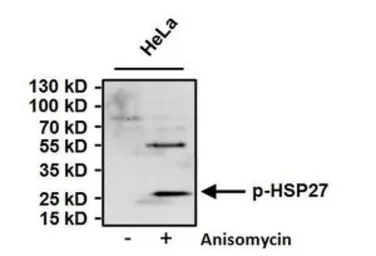 Anti-HSP27 (phospho Ser15) antibody used in Western Blot (WB). GTX25581