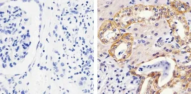 Anti-MEK1 (phospho Thr292) antibody used in IHC (Paraffin sections) (IHC-P). GTX25612