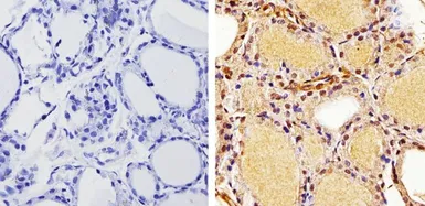 Anti-Thyroid Hormone Receptor alpha antibody used in IHC (Paraffin sections) (IHC-P). GTX25621