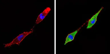 Anti-Thyroid Hormone Receptor alpha antibody used in Immunocytochemistry/ Immunofluorescence (ICC/IF). GTX25621