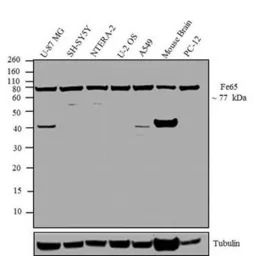 Anti-FE65 antibody used in Western Blot (WB). GTX25668