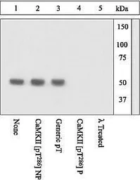 Anti-CaMKII alpha (phospho Thr286) antibody used in Western Blot (WB). GTX25683