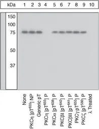 Anti-PKC eta (phospho Thr655) antibody used in Western Blot (WB). GTX25798