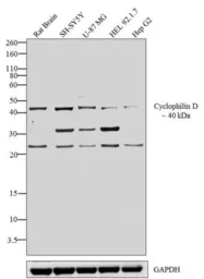 Anti-Cyclophilin 40 antibody used in Western Blot (WB). GTX25902