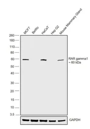 Anti-Retinoic Acid Receptor gamma antibody used in Western Blot (WB). GTX25904