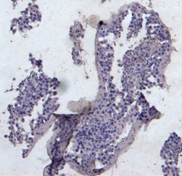 Anti-KPNA3 antibody, C-term used in IHC (Paraffin sections) (IHC-P). GTX26038