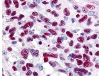 Anti-GLI3 antibody used in IHC (Paraffin sections) (IHC-P). GTX26050