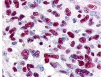 Anti-GLI3 antibody used in IHC (Paraffin sections) (IHC-P). GTX26050