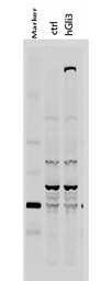 Anti-GLI3 antibody used in Western Blot (WB). GTX26050