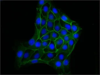 Anti-beta Catenin antibody [6F9] used in Immunocytochemistry/ Immunofluorescence (ICC/IF). GTX26300