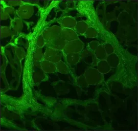 Anti-Collagen I antibody [COL-1] used in IHC (Frozen sections) (IHC-Fr). GTX26308