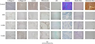 Anti-Collagen I antibody [COL-1] used in IHC (Paraffin sections) (IHC-P). GTX26308