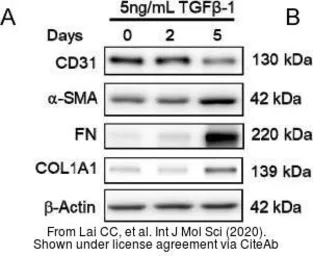 Anti-Collagen I antibody [COL-1] used in Western Blot (WB). GTX26308