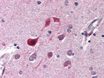 Anti-CDK5 antibody used in IHC (Paraffin sections) (IHC-P). GTX26543