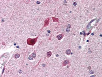 Anti-CDK5 antibody used in IHC (Paraffin sections) (IHC-P). GTX26543
